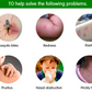 TOPONE-MOSQUTTOS krema 20g- bez aditiva,Prirodna zaštita od komaraca i za posle ubode insekata-Blaga,umirujuća,nemasna i potpuno prirodna biljna formula- krema Idealna za bebe,decu,odrasle,ribolovce;1 +1 (Gratis)